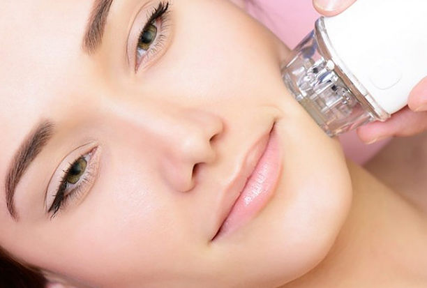 Microneedling RF